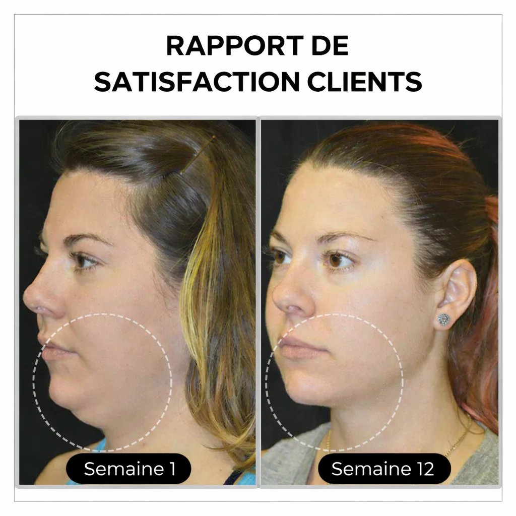 (🔥 DERNIER JOUR – SOLDES 80%)💎 CZTICLE® Histone Magnetology Lymphvity Boucles d’Oreilles en Germanium - Image 3
