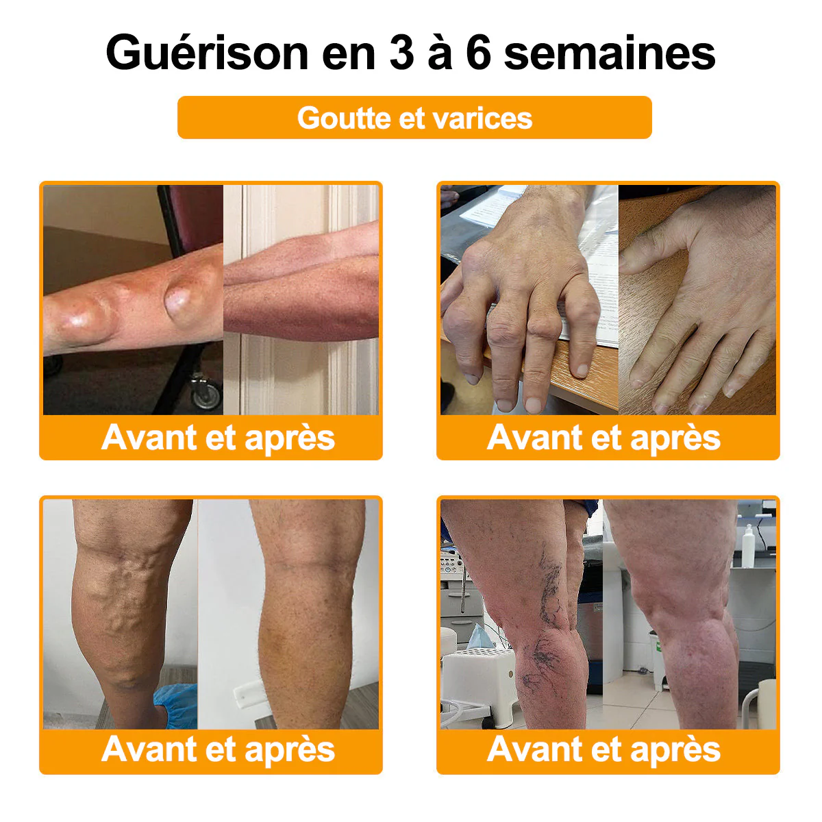 Purelora® Venin d'abeille Crème cicatrisante osseuse Pain-Relief 🐝🐝(Spécialement conçu pour les personnes âgées & Recommandé par Chirurgien) - Image 4