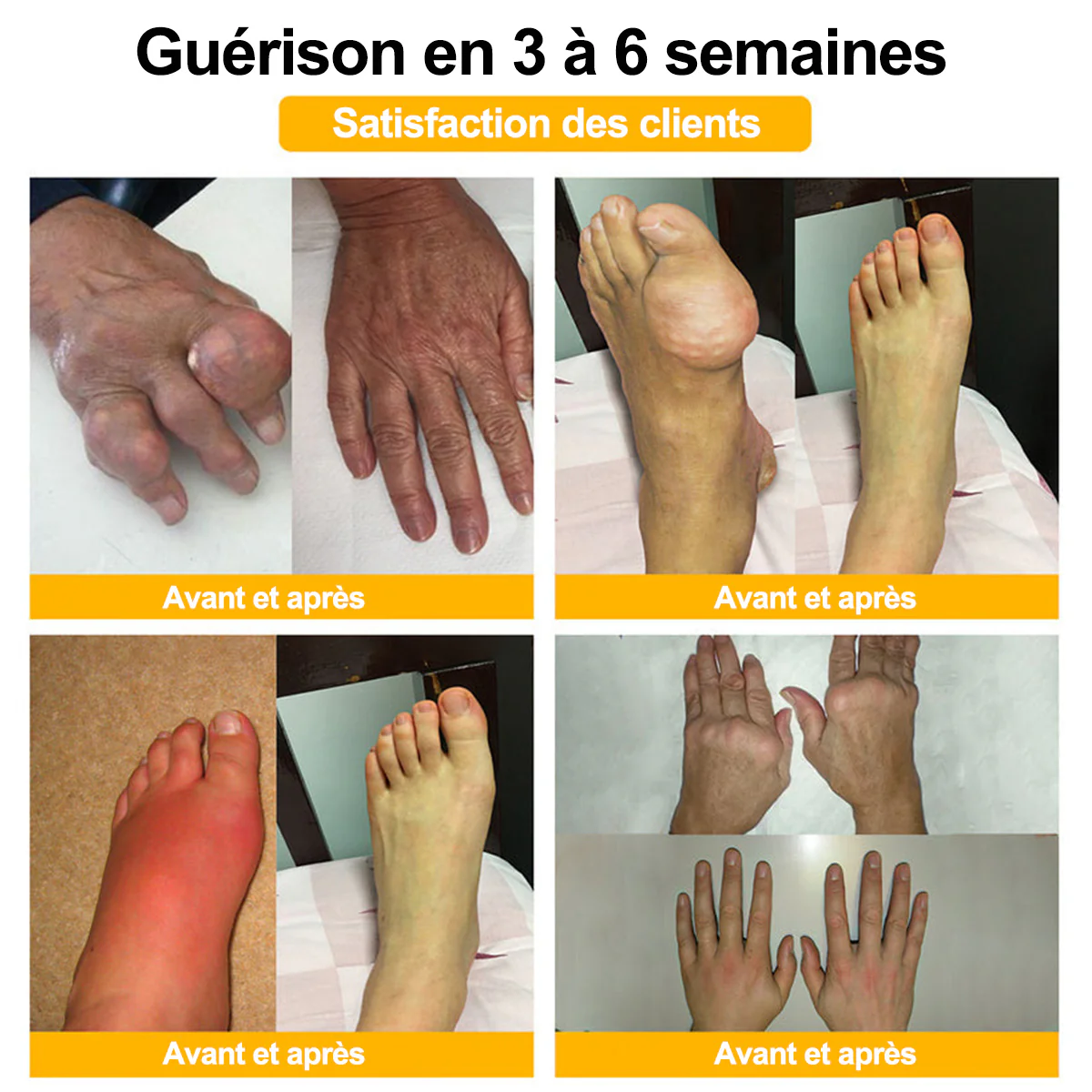 Purelora® Venin d'abeille Crème cicatrisante osseuse Pain-Relief 🐝🐝(Spécialement conçu pour les personnes âgées & Recommandé par Chirurgien) - Image 5