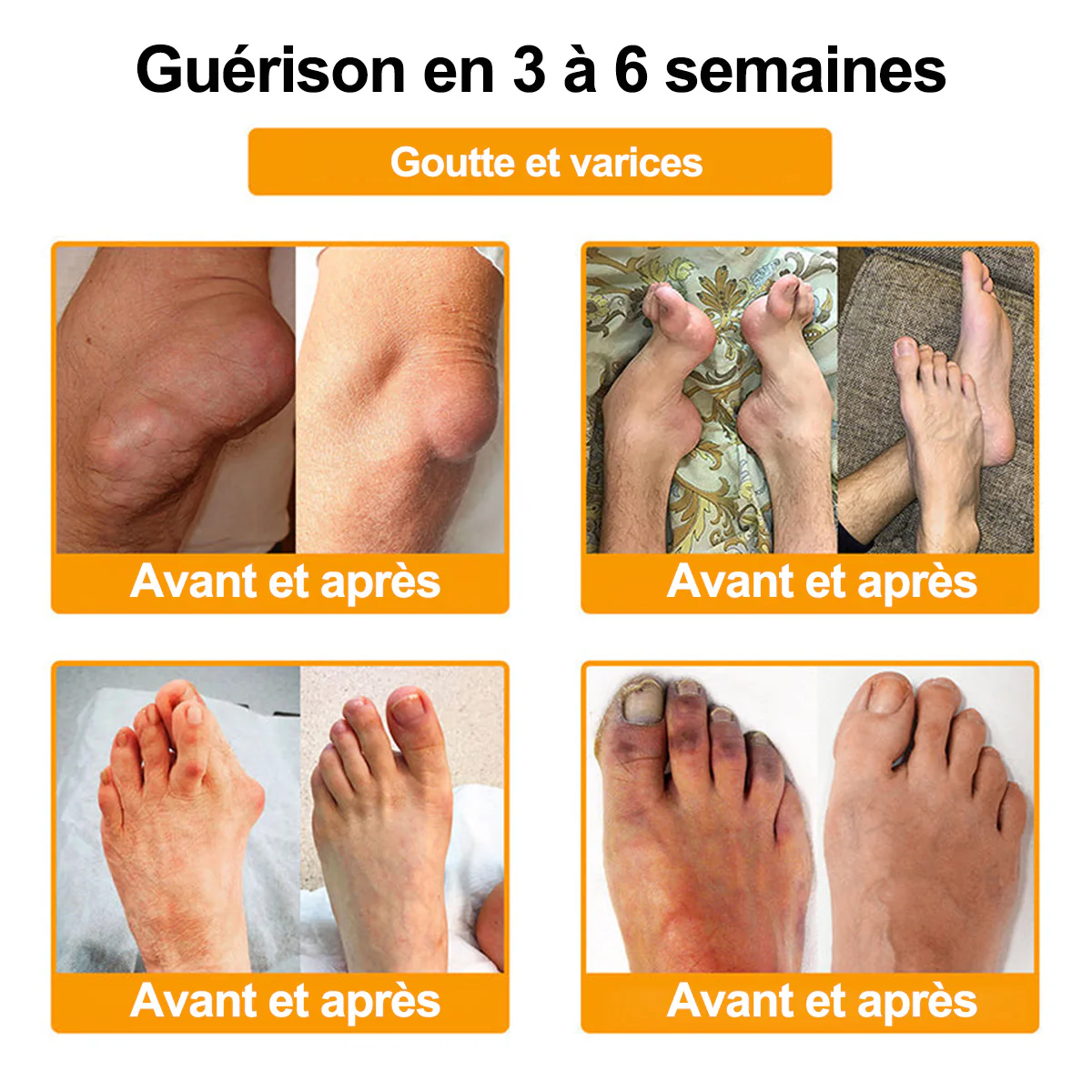 Purelora® Venin d'abeille Crème cicatrisante osseuse Pain-Relief 🐝🐝(Spécialement conçu pour les personnes âgées & Recommandé par Chirurgien) - Image 6