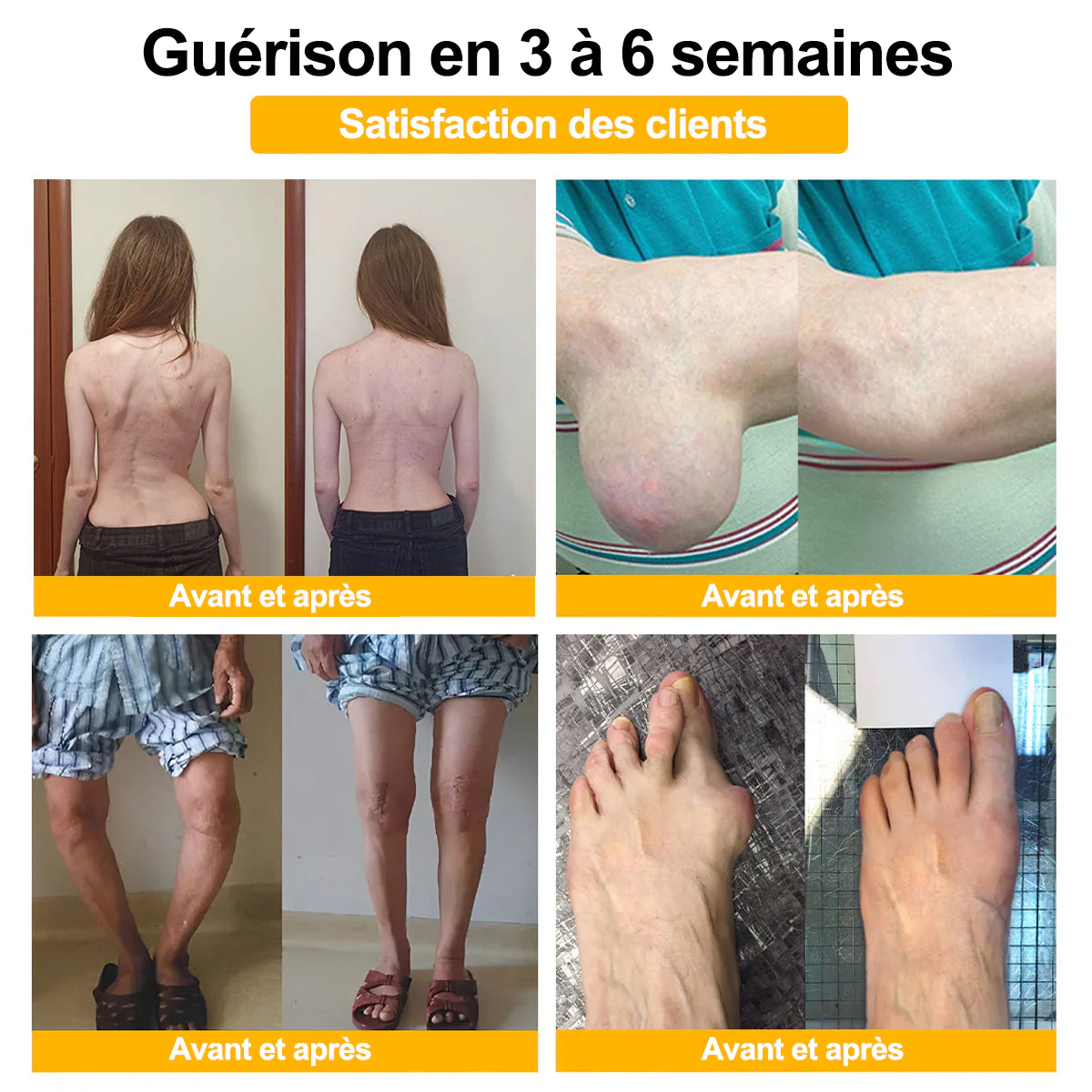 Purelora® Venin d'abeille Crème cicatrisante osseuse Pain-Relief 🐝🐝(Spécialement conçu pour les personnes âgées & Recommandé par Chirurgien) - Image 7