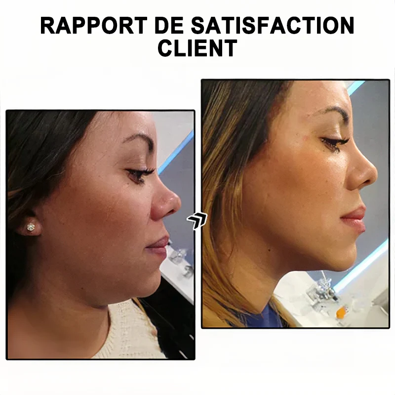 🔥𝐂𝐙𝐓𝐈𝐂𝐋𝐄® Lymphvity MagneTherapy Boucles d'oreilles en Germanium💎 (Portées une fois par jour, changements visibles en 7 jours) Soutien contre le surpoids, le diabète, l'apnée du sommeil et les douleurs articulaires 🍃 - Image 4