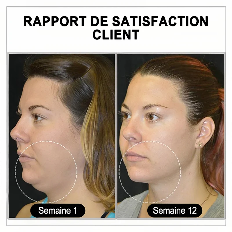 🔥𝐂𝐙𝐓𝐈𝐂𝐋𝐄® Lymphvity MagneTherapy Boucles d'oreilles en Germanium💎 (Portées une fois par jour, changements visibles en 7 jours) Soutien contre le surpoids, le diabète, l'apnée du sommeil et les douleurs articulaires 🍃 - Image 7